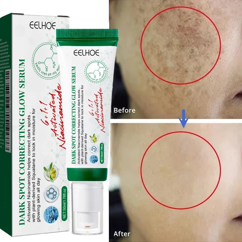 Nicotinamide Whitening Freckles Face Cream Remove Melasma Dark Spots Corrector Fade Melanin Acne Anti-Aging Brighten Skin Care
