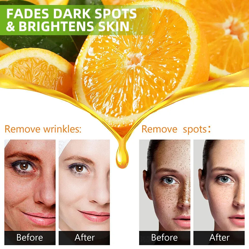Lemon VC Facial Serum Brightens Skin Tone Fades Acne Marks Evens Complexion 50x Vitamin C Whitening Essence for Radiant Glow