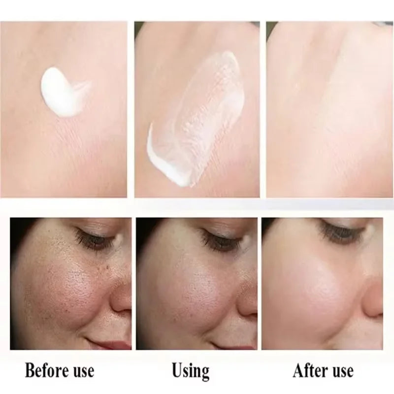 Nicotinamide Whitening Freckles Face Cream Remove Melasma Dark Spots Corrector Fade Melanin Acne Anti-Aging Brighten Skin Care