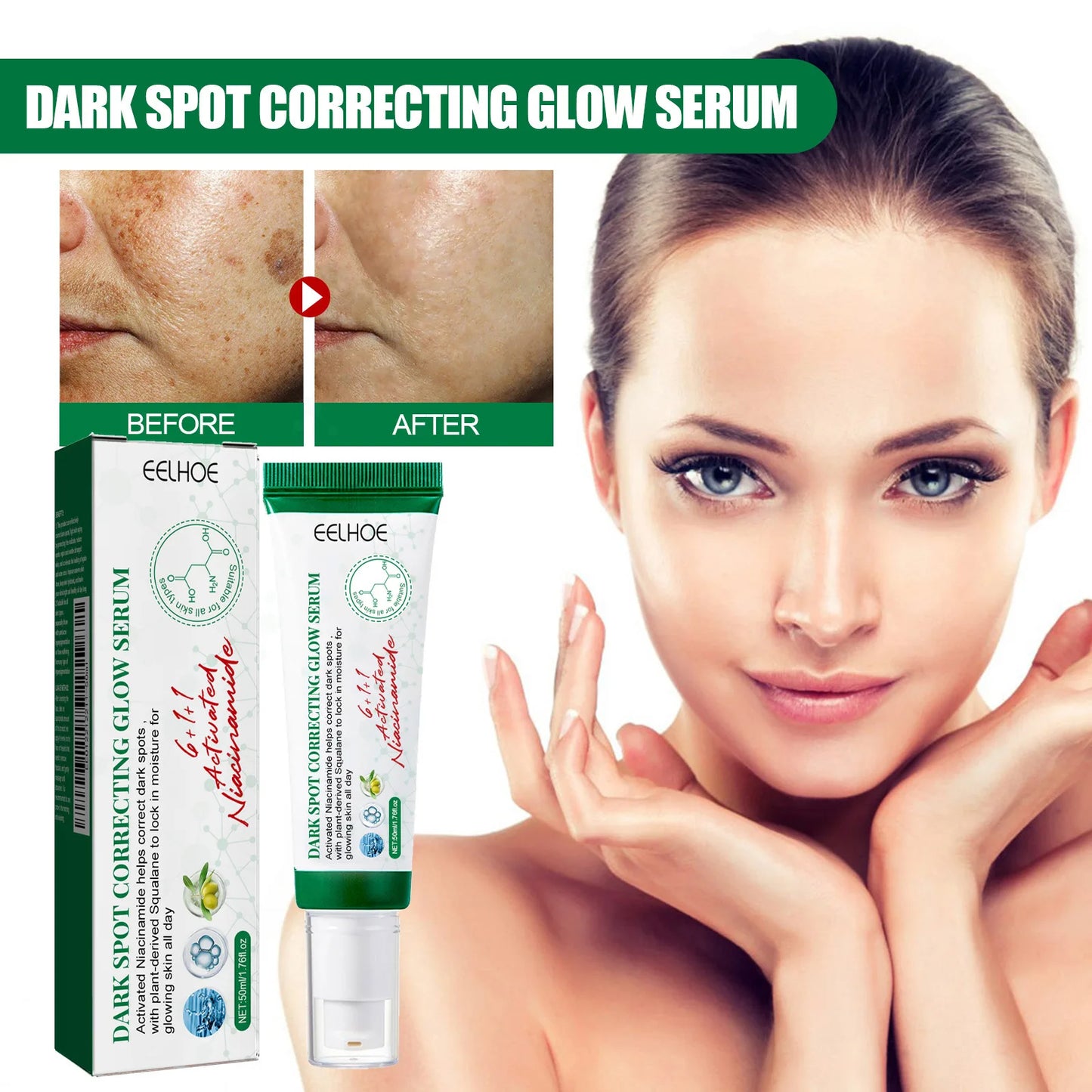 Nicotinamide Whitening Freckles Face Cream Remove Melasma Dark Spots Corrector Fade Melanin Acne Anti-Aging Brighten Skin Care